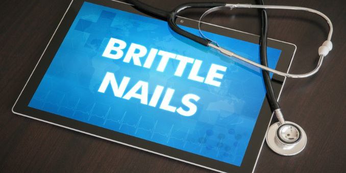 brittle nails - Brittle Nails Causes