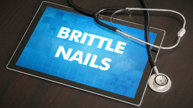brittle nails - Brittle Nails Causes