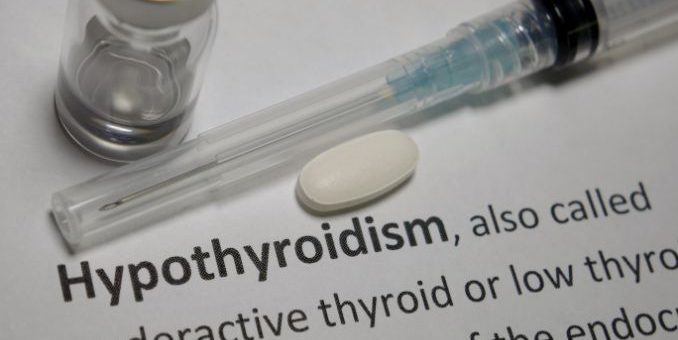 Hypothyroidism Thumbnail