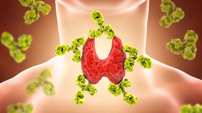 autoimmune-thyroiditis - Hashimoto's Thyroiditis Diet