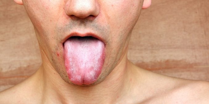 Biting Tongue