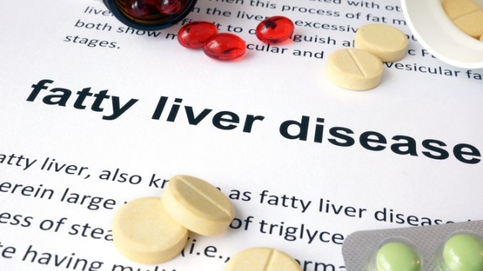 Understanding Fatty Liver Disease 